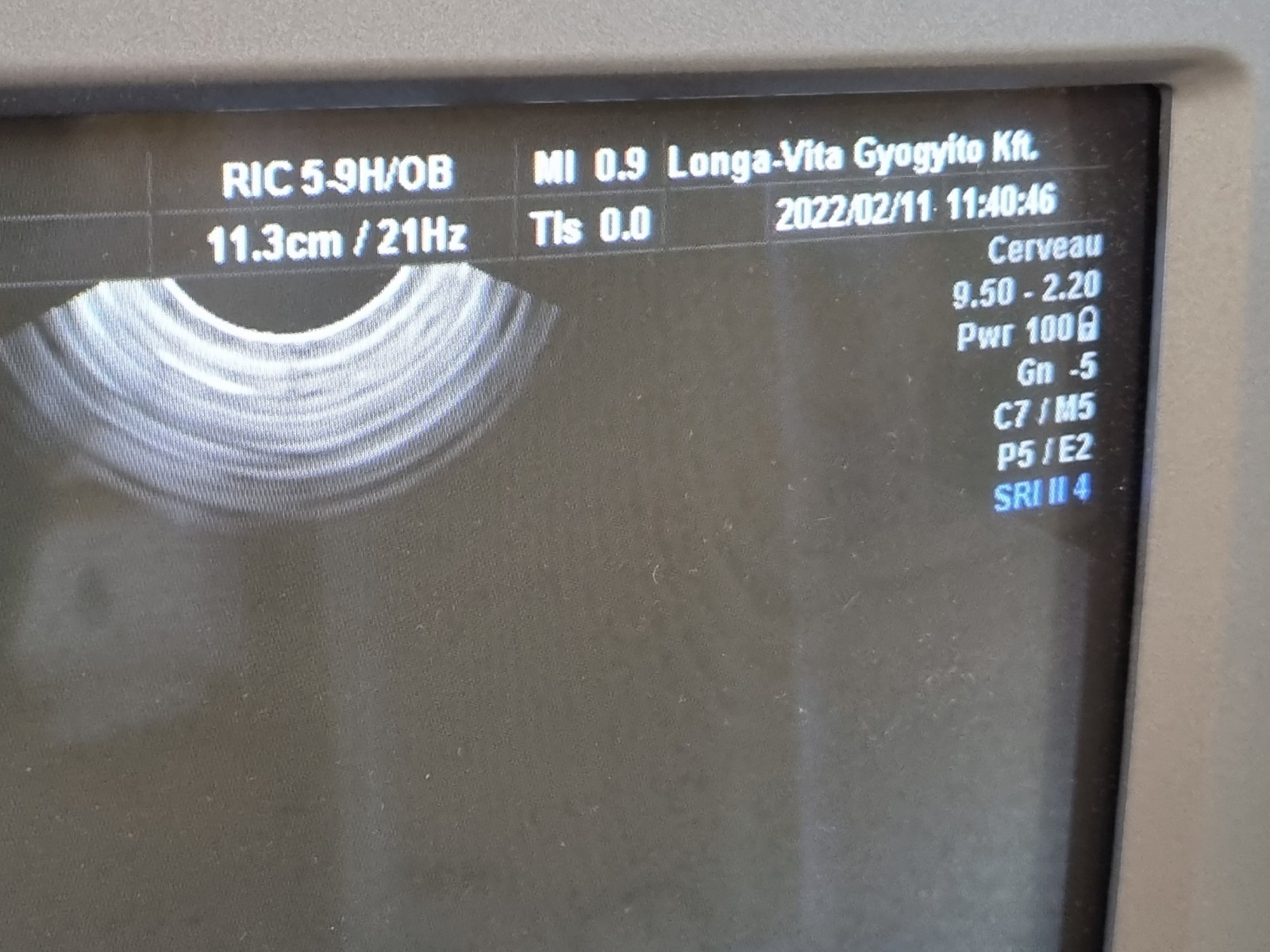 Eladó használt GE Voluson V730 Pro ultrahang készülék 4D hüvelyi vizsgálófejének ultrahang képe